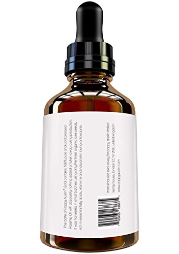 Aceite de Rosa Mosqueta - Vegano, Cruelty-Free, Orgánico, Puro y Prensado en Frío Semilla de Rosa Mosqueta - Para Suavizar e Hidratar Todo el Cuerpo - Mejor para Rostro, Piel Seca y de Acné, 60ml