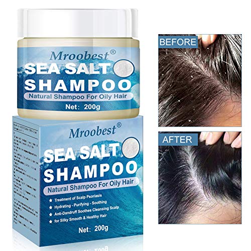 Champu Anticaspa, Psoriasis Champu, Anti Dandruff Shampoo, Champú especial para el cuero cabelludo seco/irritado/escamoso o picazón en el cuero cabelludo - 220 ml