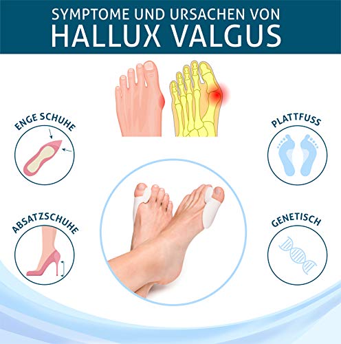 YogaMedic Hallux Valgus Corrector de Juanetes [6x] - Separador silicon de dedos - 0% BPA - Talla universal