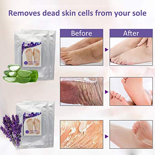 Mascarilla Pies Exfoliante Máscara Wolady 2pcs Exfoliantes Calcetines Exfoliante Pies Máscara Pies Foot Mask, Quita Cutículas y Callos, Eliminar Piel Muerta Foot Peeling Mask Hidratante y Blanqueadora