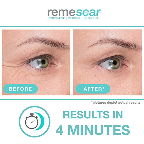 Remescar - Crema de ojos para patas de gallo - Crema de ojos clínicamente probada para reducir las patas de gallo - Crema de ojos antienvejecimiento para hombre y mujer - Resultados inmediatos