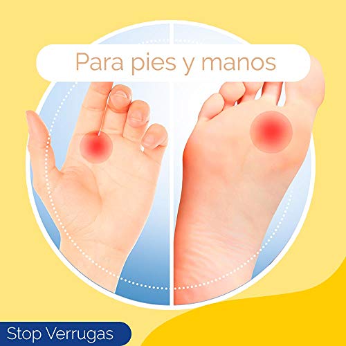 Scholl, Tratamiento Stop Verrugas Comunes y Plantares, por método de congelación, 80ml/53g