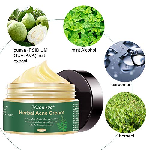 Crema Antiacne, Acné Crema, Anti Acne, Acne Tratamiento, Acne Cream, Reducir los Puntos negros, Equilibrar el Agua y el Aceite, la Crema Contra el Acné Espinilla, Regenera la piel, 100 g