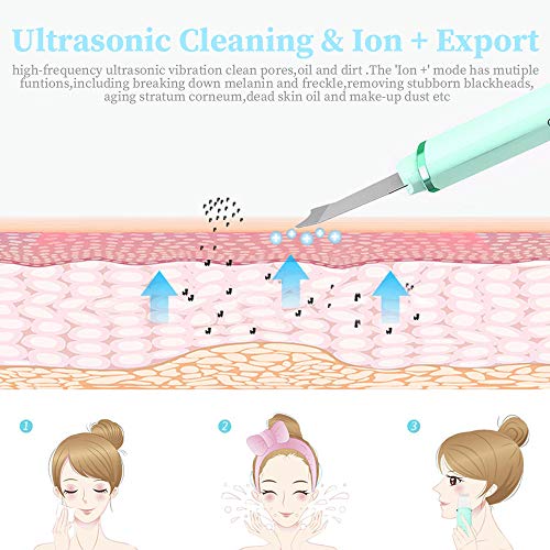 ANLAN Peeling Ultrasónico Facial Skin Scrubber Exfoliación Facial Ultrasónica Limpiador de Poros para Limpieza Facial y Cuidado Facial