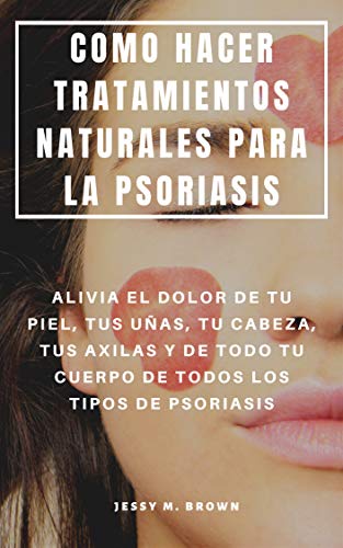 COMO HACER TRATAMIENTOS NATURALES PARA LA PSORIASIS : ALIVIA EL DOLOR DE TU PIEL, TUS UÑAS, TU CABEZA, TUS AXILAS Y DE TODO TU CUERPO DE TODOS LOS TIPOS DE PSORIASIS