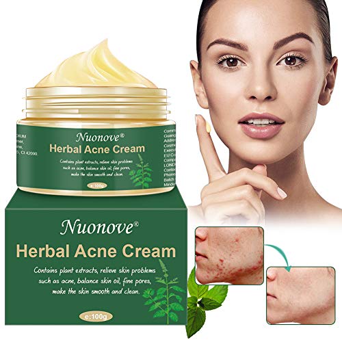 Crema Antiacne, Acné Crema, Acne Tratamiento, Reducir los Puntos negros, Acne Cream, Equilibrar el Agua y el Aceite, la Crema Contra el Acné Espinilla Regenera la piel, 100 g