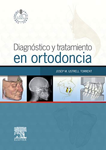 Diagnóstico Y Tratamiento En Ortodoncia. StudentConsult En Español