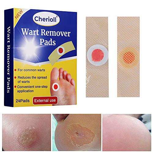 Verrugas, Wart Remover, Tratamiento Anti Verrugas Tratamiento para Quitar Verrugas Comunes y Plantares 24pc