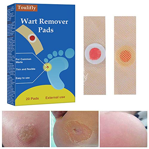 Wart Remover, Verrugas, Tratamiento Anti Verrugas Tratamiento para Quitar Verrugas Comunes y Plantares, Congela las Verrugas de Raíz, Wart Remover para Pies y Manos