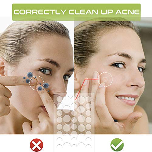 216 PCS Parches de Acné, Parches Acne hidrocoloide Invisible de 8/12mm Enmascara los Abscesos Tratamiento del Acné Enrojecimiento/Absorbe Secreciones Repara la Piel del Acné Para Hombres/Mujeres