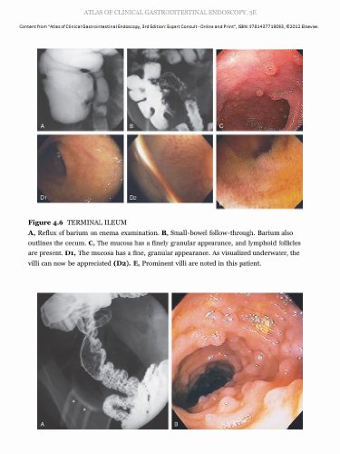 Atlas of Clinical Gastrointestinal Endoscopy: Expert Consult - Online and Print, 3e