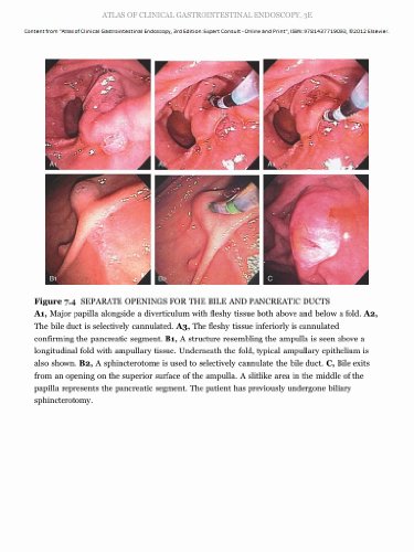 Atlas of Clinical Gastrointestinal Endoscopy: Expert Consult - Online and Print, 3e