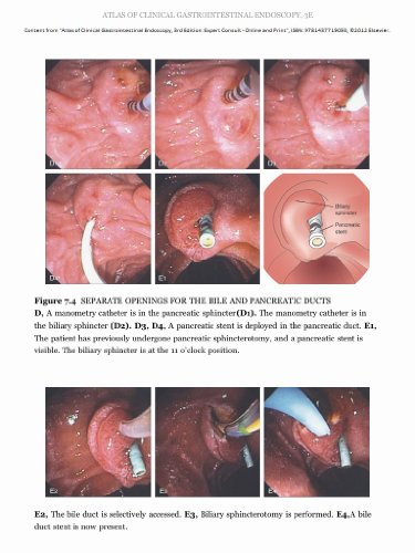 Atlas of Clinical Gastrointestinal Endoscopy: Expert Consult - Online and Print, 3e