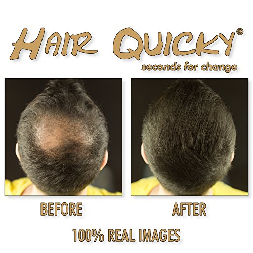 Hair Quicky® Premium Hair Fibers, fibras de pelo, construcción de pelo espesante de cabello, en caso de alopecia calvicie caída del pelo o cabello ralo, natural queratina | 28g | rubio oscuro