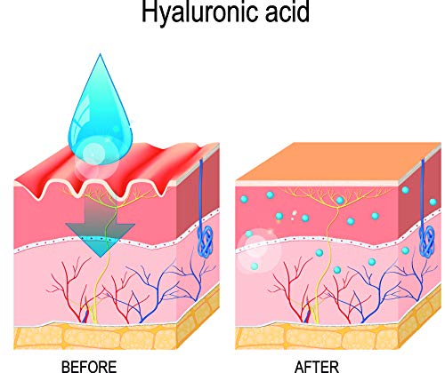 REVE Sérum Tensor con Ácido Hialurónico + Molecular Film + Aceite de Argán + Aloe Vera - Hombre y Mujer, Día y Noche - Cosmética natural sin parabenes para todo tipo de pieles - 20 ml