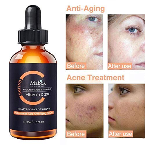 Suero de vitamina C con ácido hialurónico Vitamina E Suero facial hidratante antienvejecimiento Quite las manchas oscuras de la peca para el rostro, el cuello y el escote, 30ml