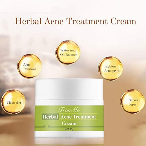 Crema de acné, crema antiespinillas, crema antiacné, equilibrio de aceite sano con hierbas naturales, contra el acné y las impurezas, protege el acné, cuida y regenera piel