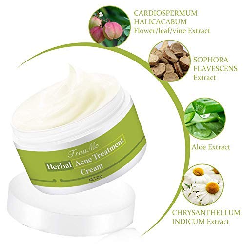 Crema de acné, crema antiespinillas, crema antiacné, equilibrio de aceite sano con hierbas naturales, contra el acné y las impurezas, protege el acné, cuida y regenera piel