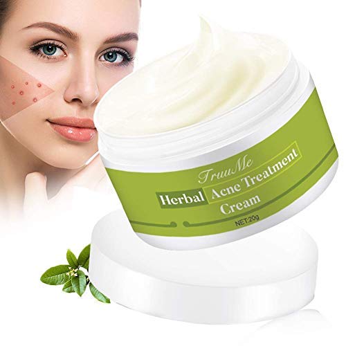 Crema de acné, crema antiespinillas, crema antiacné, equilibrio de aceite sano con hierbas naturales, contra el acné y las impurezas, protege el acné, cuida y regenera piel