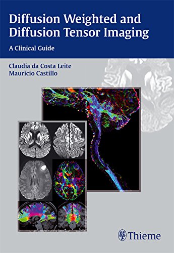 Diffusion Weighted and Diffusion Tensor Imaging: A Clinical Guide (English Edition)