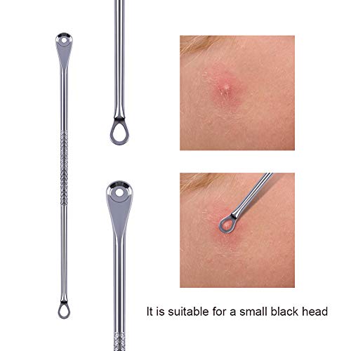 Eono by Amazon - Puntos Negros Aguja Extractor Limpiador Juego de 4Pcs Kit Blackhead Remover para Quita Espinillas Negros Comedones Herramientas