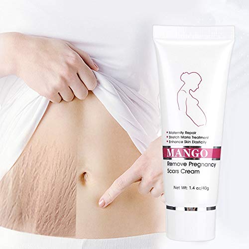 Anti-estrías posparto para diluir las estrías, reparar la crema corporal hidratante abdominal, líneas de grasa, eliminar las líneas de obesidad para reforzar los productos de prevención para