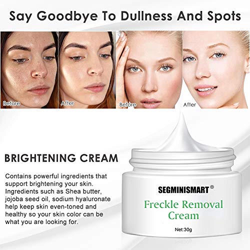 Anti Manchas Cara,Anti Manchas Piel,Crema Blanqueadora,Crema Antimanchas Facial Antiedad, Anti Manchas Regeneradora y aclarante,Crema Hidratante para la cara