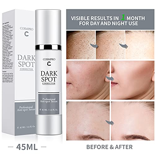 Cosmpro Serum Antimanchas para Peeling Facial, 45ml Despigmentante Facial Manchas Piel, Manchas cara Eliminación, Tratamiento de Manchas de Edad & Mancha de Sol, Dark Spot Remover for Face and Body