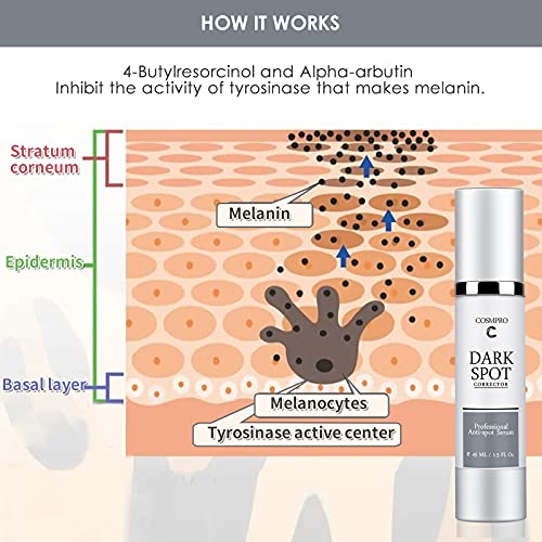 Cosmpro Serum Antimanchas para Peeling Facial, 45ml Despigmentante Facial Manchas Piel, Manchas cara Eliminación, Tratamiento de Manchas de Edad & Mancha de Sol, Dark Spot Remover for Face and Body