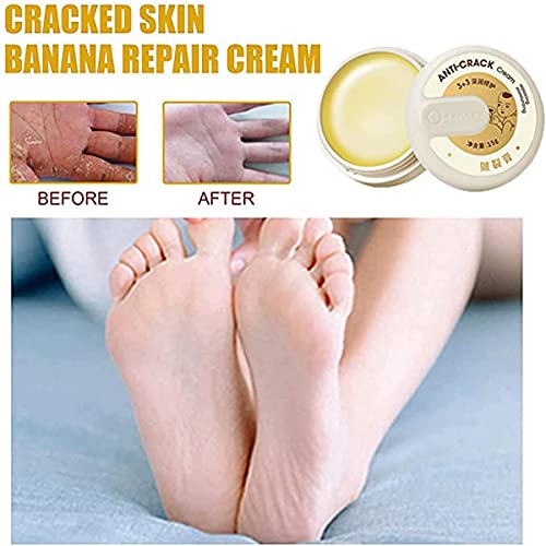 Cracked Skin Repair Cream,Multi-Purpose Dry Skin Balm,Anti Crack&Hand Foot Cream,Baby Cracking Cream,moisturizing Cream for Adults and Kids. (1PCS)