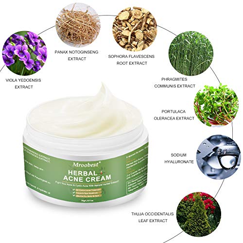 Crema Antiacne, Acné Crema, Herbal Acne Cream, Acne Tratamiento, Equilibrar el Agua y el Aceite, Acné Fosos de Reparar, la Crema Contra el Acné Espinilla, Regenera la piel - 50g/1.76 fl oz