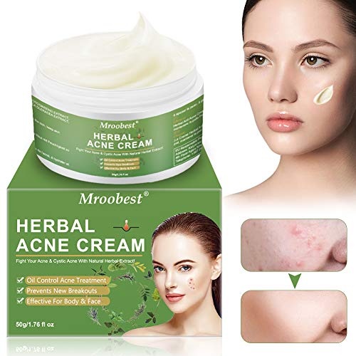 Crema Antiacne, Acné Crema, Herbal Acne Cream, Acne Tratamiento, Equilibrar el Agua y el Aceite, Acné Fosos de Reparar, la Crema Contra el Acné Espinilla, Regenera la piel - 50g/1.76 fl oz