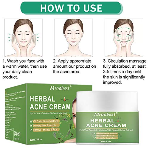 Crema Antiacne, Acné Crema, Herbal Acne Cream, Acne Tratamiento, Equilibrar el Agua y el Aceite, Acné Fosos de Reparar, la Crema Contra el Acné Espinilla, Regenera la piel - 50g/1.76 fl oz