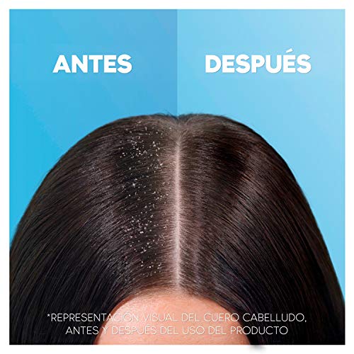 H&S Hidratación profunda Champú Anticaspa clínicamente probado, pelo libre de caspa, graso, con Aceite de Coco, sin parabenos, 40% envase plástico reciclado, cuidado suave del pelo, 6 x 340 ml