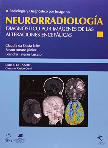 Neurorradiología. Diagnóstico por Imágenes de las Alteraciones Encefálicas (Em Portuguese do Brasil)