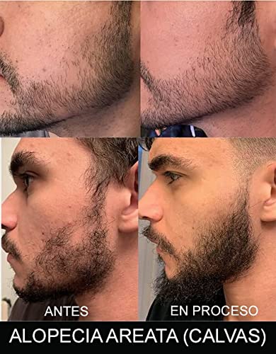 Nuevo en Amazon! Pack Incenvador de Crecimiento para Barba. 92% de efectividad. Producto más vendido en España 2021 en su categoría