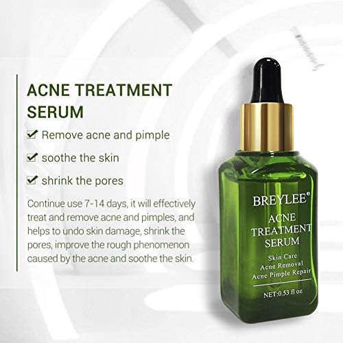 ARTIFUN Acné Tratamiento Anti Acne Serum, Eliminar Espinillas, Puntos Negros y Granos, Anti Imperfecciones Tratamiento contra el acne