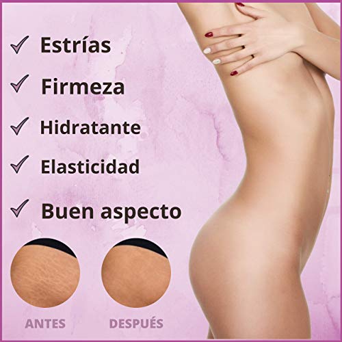 Crema Antiestrías Embarazo Intensiva. Frena, previene y trata las estrías. Potente Crema Reafirmante Corporal. Reafirma, tonifica e hidrata la piel. Fórmula Mejorada 200ml