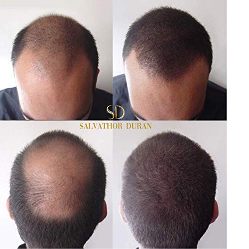 Fibras Capilares Salvathor Duran 25 gramos - Keratin Fibers - Disimula Alopecia - Cubre Caída del Cabello - Retoca y Crea Volumen del Pelo de Hombres y Mujeres - Hair Fiber (Castaño Medio)