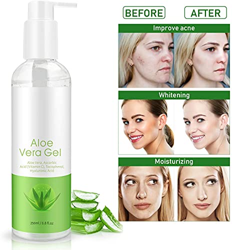 Gel Aloe Vera Puro con áCido HialuróNico 250ML - OrgáNico Natural Aloe Vera Gel 100% Para La Cara, Cuerpo, Cabello, Cuidado De Las Quemaduras Solares