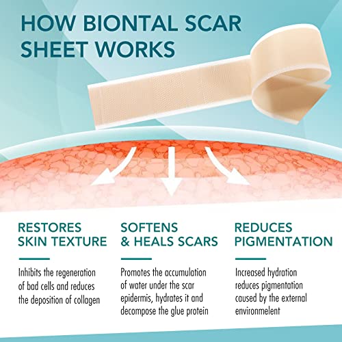 Hojas de Cicatriz de Silicona 1.6 "X 60" , Tratamientos para reducir cicatrices, profesionales para cicatrices causadas por cesárea, cirugía, quemaduras, queloides, acné y más