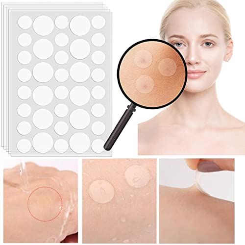 ILamourCar Parches Para Acné, Parches para Granos, 180 Piezas Hydrocolloid Patches Invisibles de 8/12 mm, para el Tratamiento del Acné Facial