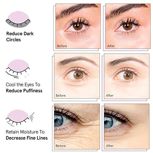 Parches debajo de ojos Grace & Stella para círculos oscuros e hinchazón - Veganos - Parches de gel debajo de la máscara de ojos para reducir el tejido flojo (24 Pair Pink)