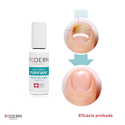 PODERM - TRATAMIENTO HONGOS UÑAS PIES | Plantas excepcionales potentes antihongos, reparadoras, purificantes y revitalizantes | Cuidado profesional pie/mano |Fácil & rápido | Hecho en Suiza