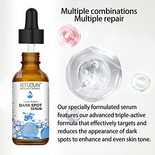 Suero Manchas Oscuras, Dark Spot Serum Suero Anti-manchas con ácido Kójico, ácido Hialurónico y Niacinamida, Mejora de las Manchas Oscuras para la Cara, Manchas Oscuras y Manchas Solares - 30 ml