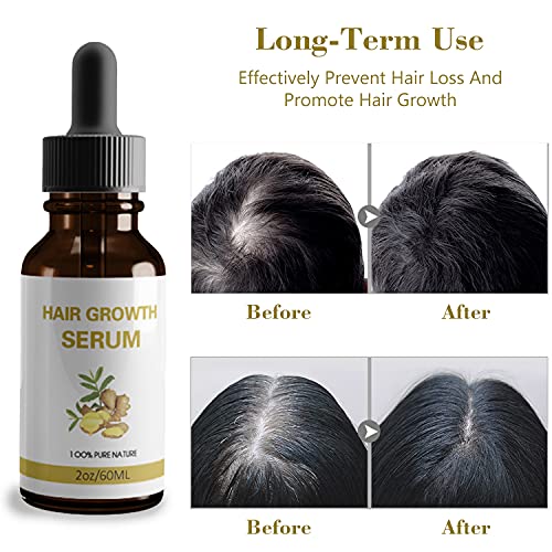 Thnkstaps Sérum Para Crecimiento del Cabello Hair Serum Anti Pérdida de Pelo Tratamiento para reducir la pérdida del cabello y promover el crecimiento del cabello Para Hombres Y Mujeres 60ML