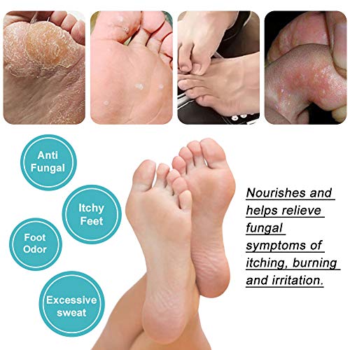 Athletes Foot Spray, Spray para pies, Pies Fungus Treatment, Pies Treatment, Ayuda a tratar y restaurar la apariencia del