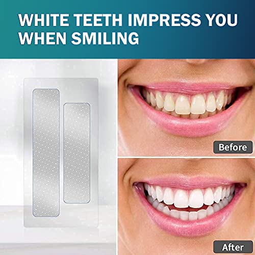 Blanqueador Dental, 14 Tiras Blanqueadoras Dientes,Teeth Whitening Strips,Reduce Sensibilidad Dental,Eliminación Profesional de manchas de dientes