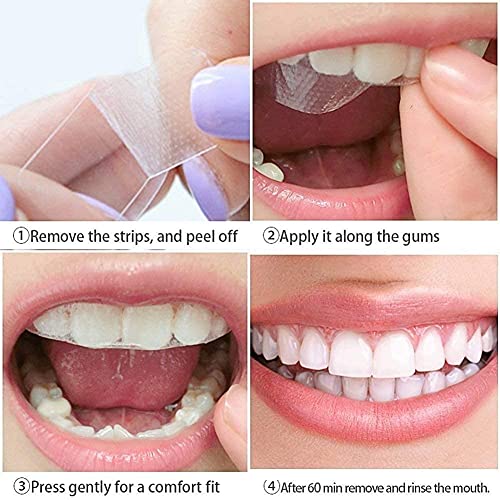 Blanqueador Dental, 14 Tiras Blanqueadoras Dientes,Teeth Whitening Strips,Reduce Sensibilidad Dental,Eliminación Profesional de manchas de dientes