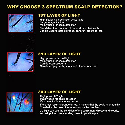 Detector de cuero cabelludo Analizador de piel capilar, Máquina analizadora de folículos capilares de cuero cabelludo de alta definición de 15'' 100X Detección digital de la salud de la piel(EU)